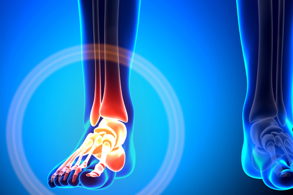 Ankle-and-Foot